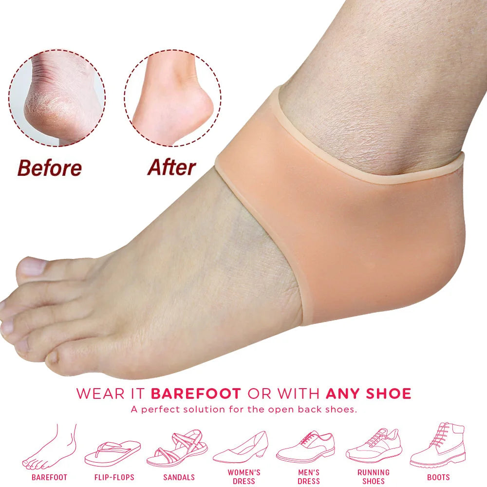 2Pcs Gel Heel Protectors Soft Heel Cups Cushions Heel Pain and Cracked Heels Relief for Men and Women Foot Care Tool