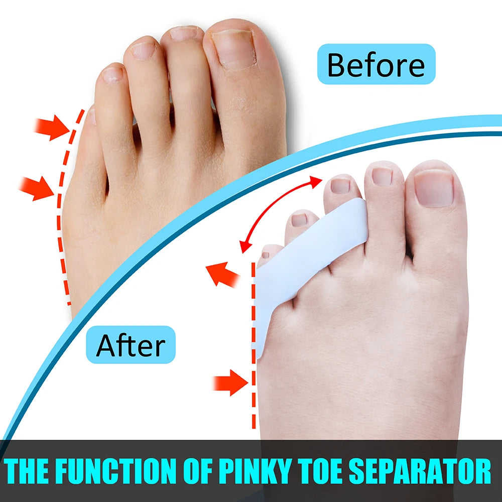 2Pcs Toe Separator Pinky Toe Straightener Protector, Bunion Pain Relief