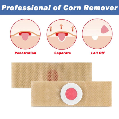 1/2/5/10Pcs Corn Remover Pads for Feet & Toes Fast-Acting Corn Treatment Foot Care Toe Protection Corn Removal Patches