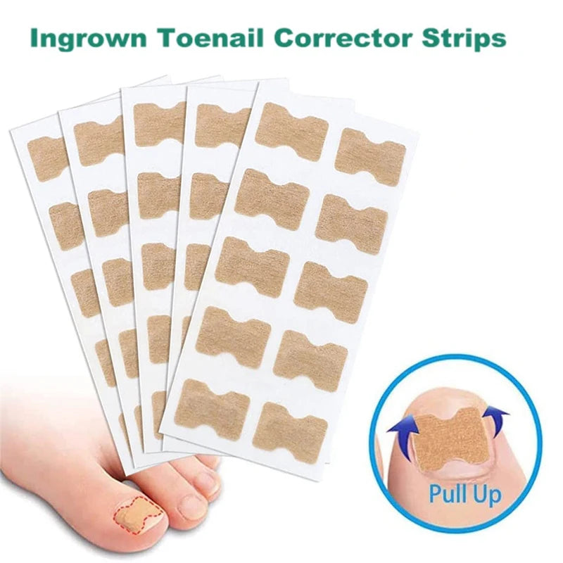 Ingrown Toenail Correction Sticker Foot Care Kit Toenail Corrector Pedicure Tool Toe nail Patch