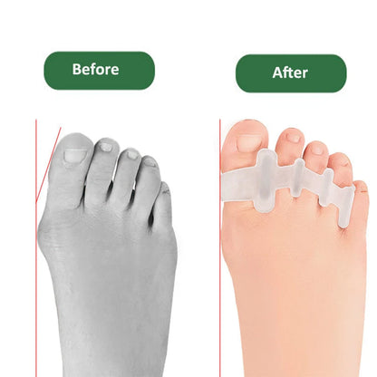 2Pcs/Pair Gel Toe Separator, Protector ,Straightener, Corrector, and Pain Relieve