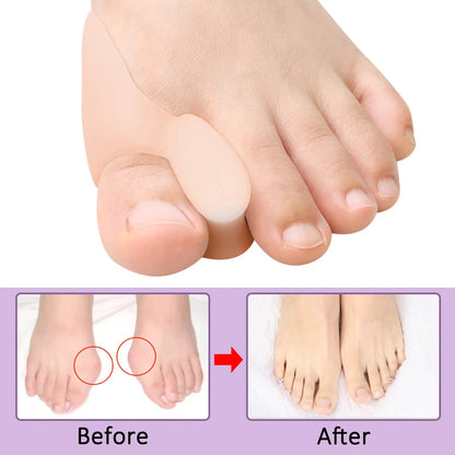 2/4/8 Pcs Toe Separator, Bunion Corrector Pain Relief, Straighter, and Protector