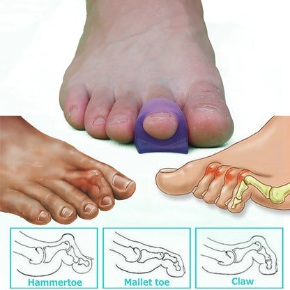 2/4/10Pcs Hammer Toe Corrector, Straightenersand Hammer Toes Bunion Corrector