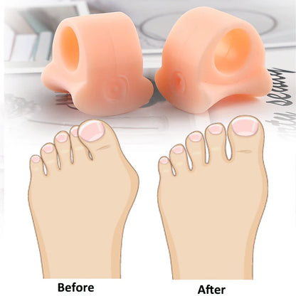 2Pcs/Pair Gel Big Toe Separator for Overlapping Hammer