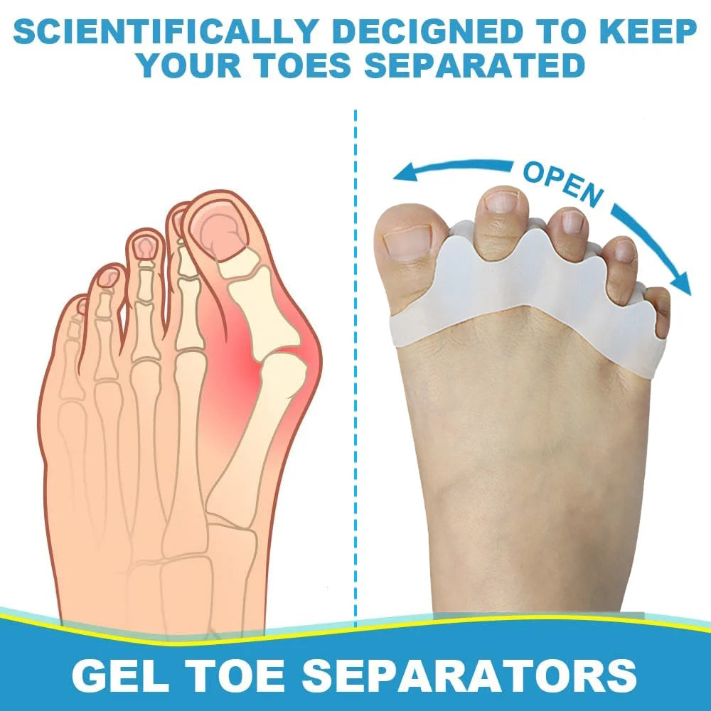 2Pcs Toe Separator to Correct Bunion and Restore Toes