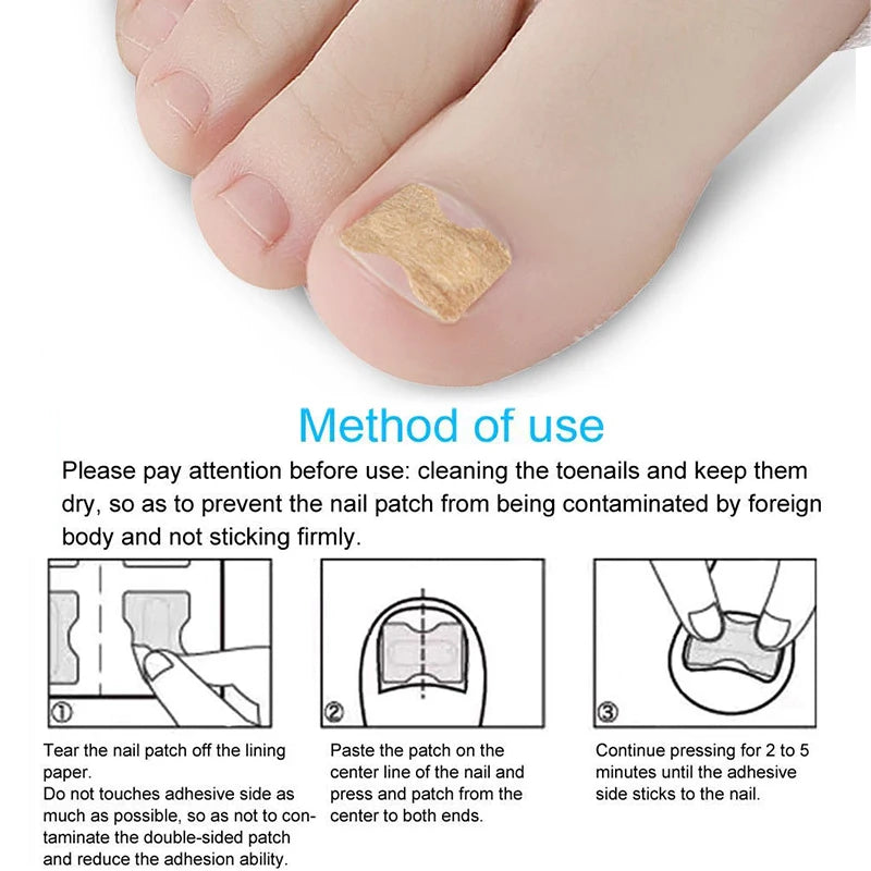 Ingrown Toenail Correction Sticker Foot Care Kit Toenail Corrector Pedicure Tool Toe nail Patch