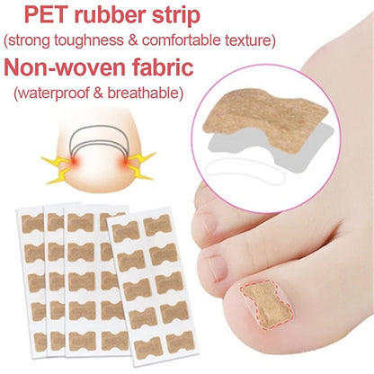 Ingrown Toenail Correction Sticker Foot Care Kit Toenail Corrector Pedicure Tool Toe nail Patch