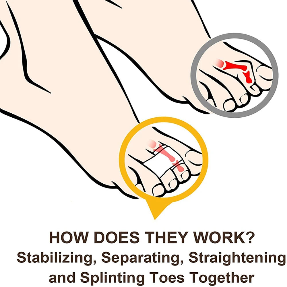 1/2/5/10Pcs Hammer Toe Straightener Toe Splints Wraps Toe Cushions Bandages for Hammertoe Crooked & Overlapping Toes