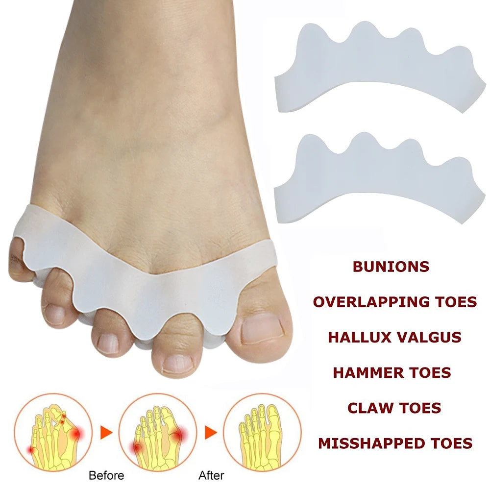 2Pcs Toe Separator to Correct Bunion and Restore Toes