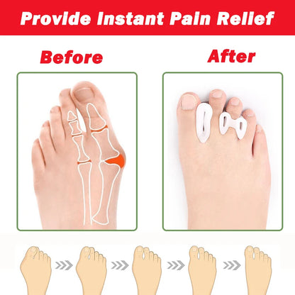 2Pcs Gel Toe Separators & Ball of Foot Cushions ,Pain Relief